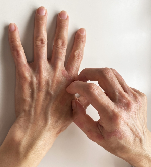 【体験談】薬なしで沈静化している奇跡！